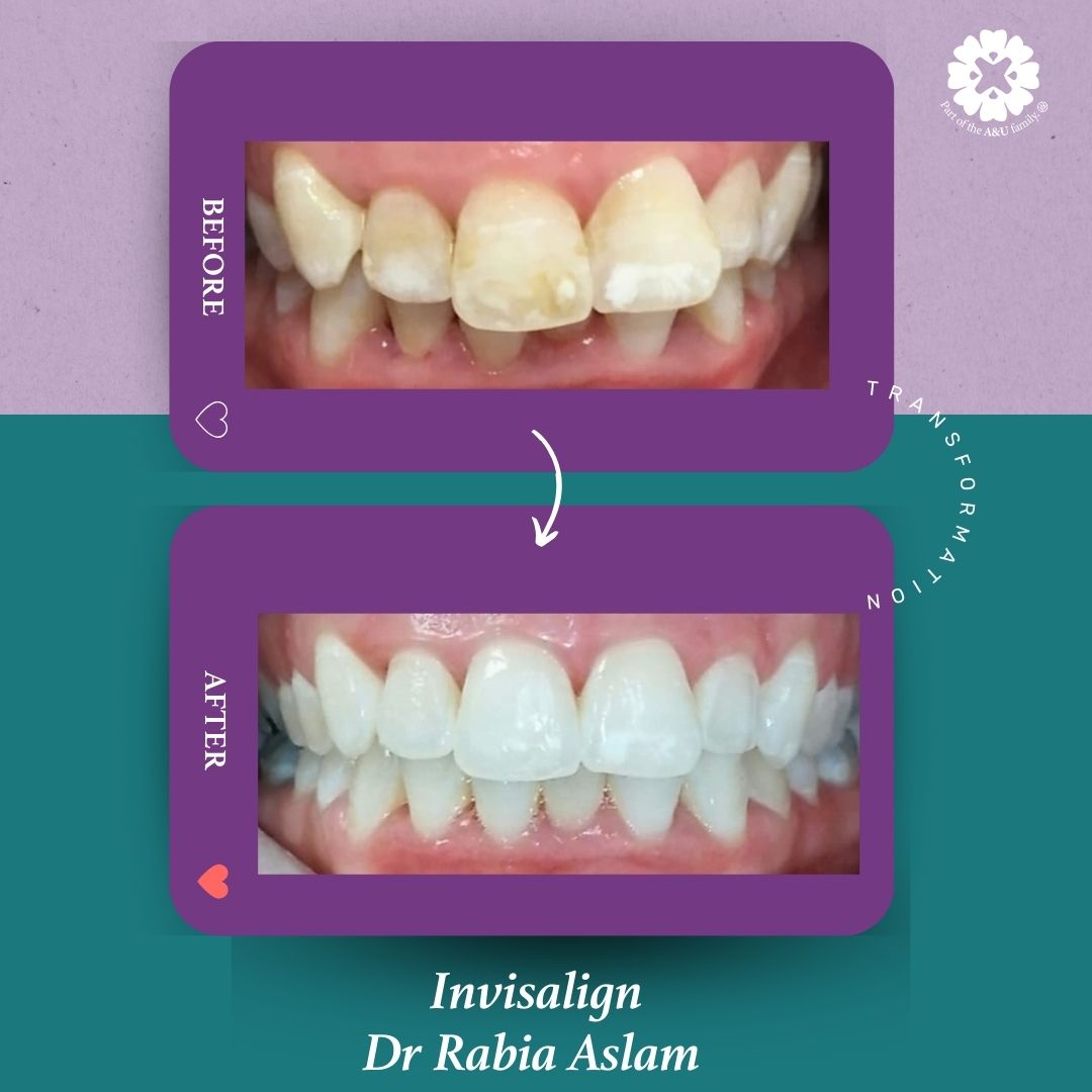 ADC - Dr Rabia - Before and After (1)