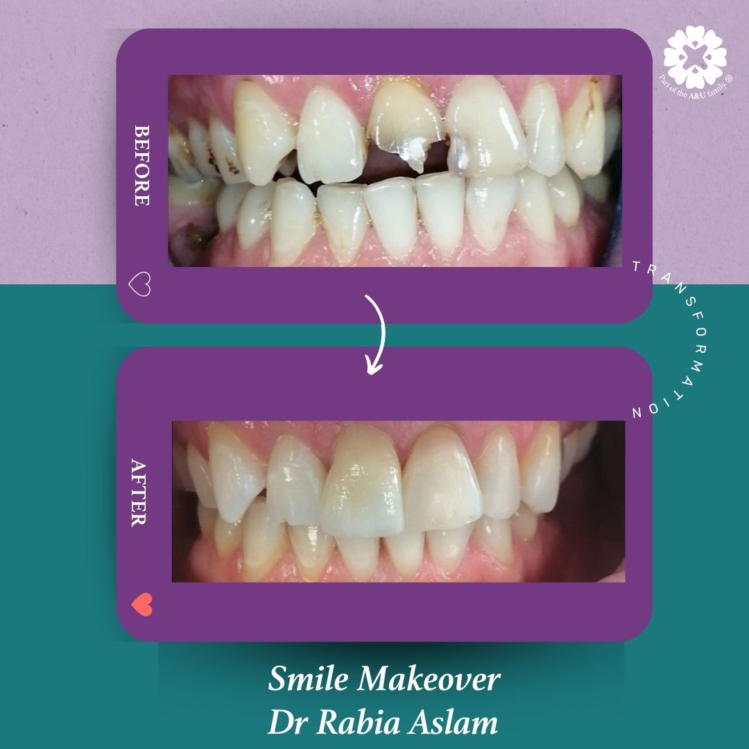 ADC - Dr Rabia - Before and After (10)
