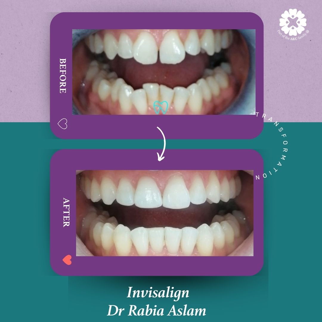 ADC - Dr Rabia - Before and After (2)